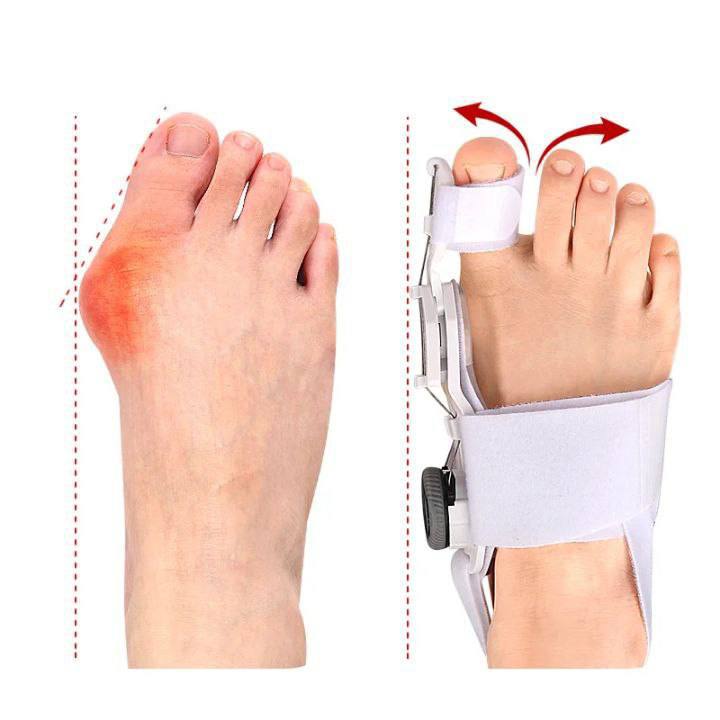 ALINEA corrector de dedo gordo con botón ajustable